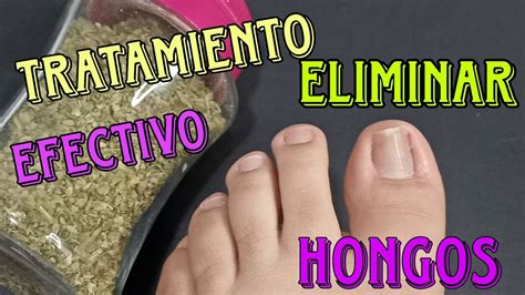 Tratamiento Para Eliminar Hongos En Las Uñas De Pies Oregano Para Quitar Hongos Youtube