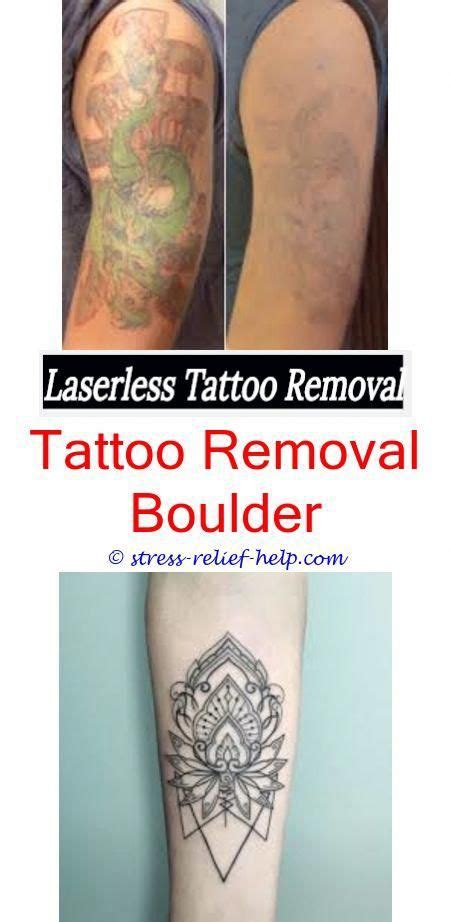 Can Tattoo Removal Ruin Hairhow To Remove Temporary Tattoos Easyhow