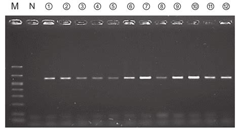 Amplification Of The 16s Rrna Gene Using Bacterial Genomic Dna Samples Download Scientific