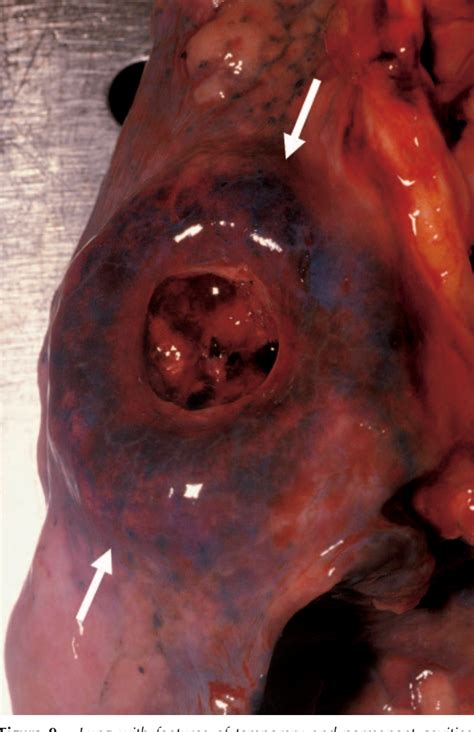 Figure From Practical Pathology Of Gunshot Wounds Semantic Scholar