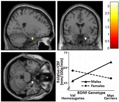 Bdnf Genotype X Sex Interaction Affects Rcbf Download Scientific Diagram