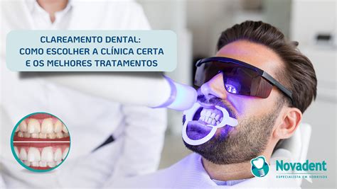 TIPOS DE CLAREAMENTO DENTAL E SEUS EFEITOS NovaDent 2024