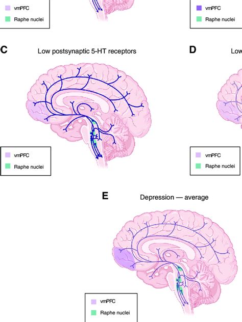 A Serotonin 5 Ht Pathways In The Brain Of Healthy Individual And In Download Scientific