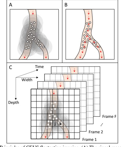 Figure From Super Resolution Ultrasound Imaging Of Vascular