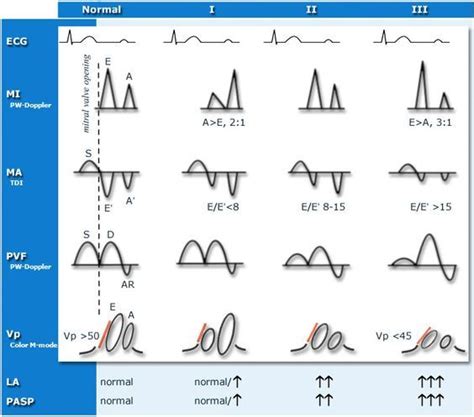 What Is Mild Lv Diastolic Dysfunction | Natural Resource Department