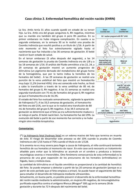 Caso Cl Nico B Casos Cl Nicos Caso Cl Nico Enfermedad Hemol Tica