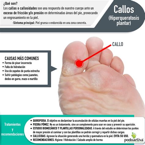 Callos en los pies o callosidades Qué son cómo tratarlos y cómo