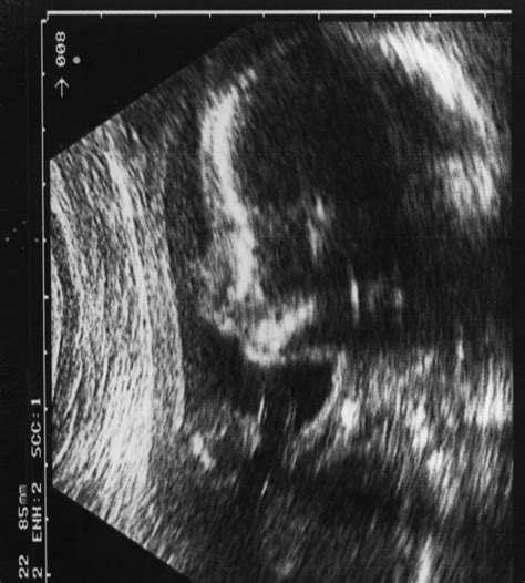 ultrasound image   fetal face  scientific diagram