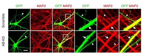 Brain Specific Drp Regulates Postsynaptic Endocytosis And Dendrite