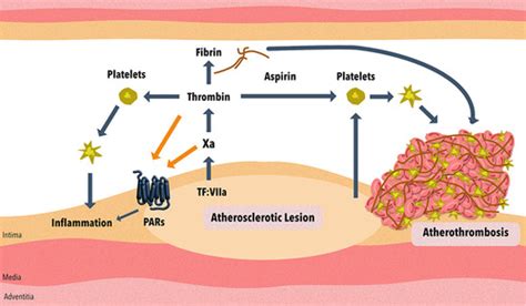 Dual Anticoagulant And Antiplatelet Therapy For Coronary Artery Disease