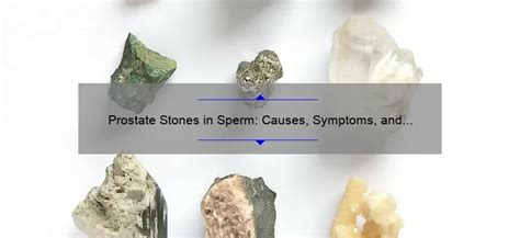 Prostate Stones in Sperm: Causes, Symptoms, and Treatment - Sperm.Blog