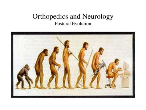 Ppt Orthopedics And Neurology Dx 612 Postural Assessment Powerpoint