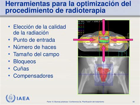 Ppt Protecci N Radiol Gica En Radioterapia Powerpoint Presentation