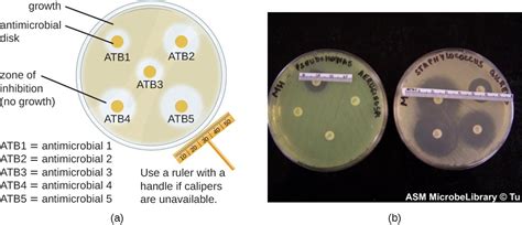 Testing The Effectiveness Of Antiseptics And Disinfectants Microbiology