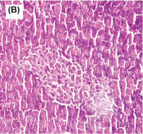 Histopathology Of The Pancreas In The Normal Control Nc Group A