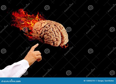 Burning Human Brain Concept Stock Image Image Of Fire Diagnosis