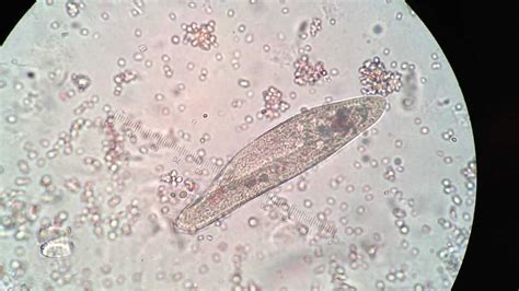 Paramecium Cell Under Microscope Labeled