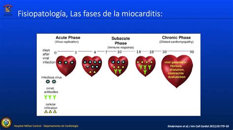 Miocarditis Aguda Enfoque Urgencias Youtube