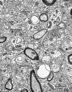 FIgure 2.5 » Fine Structure of the Aging Brain | Boston University