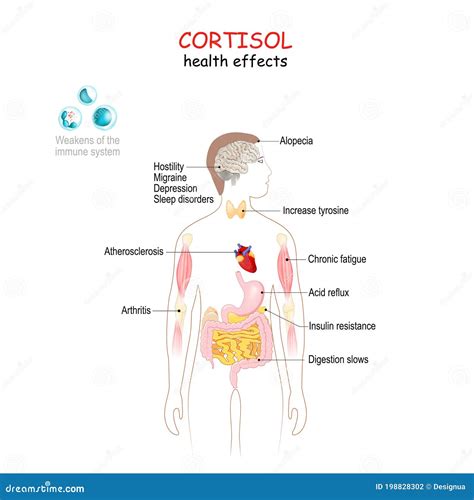 Cortisol Health Effects Human`s Body With Internal Organs Affected By