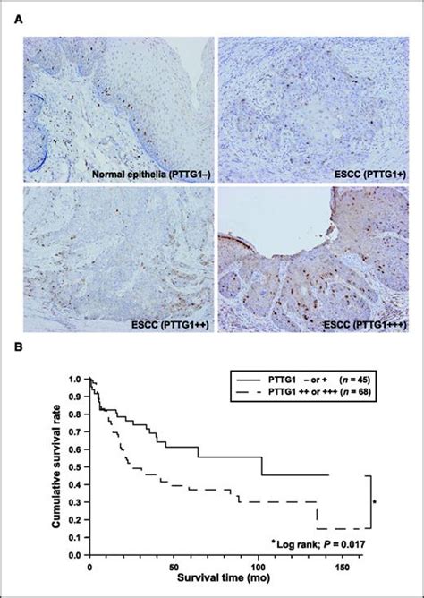 Pituitary Tumor Transforming 1 Increases Cell Motility And Promotes