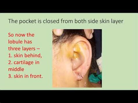 Earlobe Repair Surgery Reduction Earlobe Reconstruction Surat