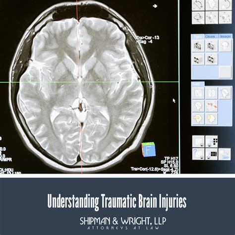 Understanding Traumatic Brain Injuries By Gary Shipman