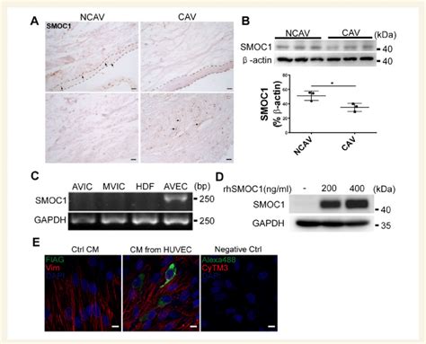 SMOC1 Is Expressed By Aortic Valve Endothelial Cells And Secreted Into