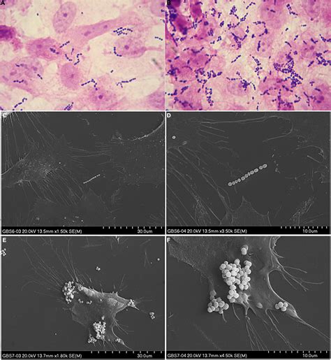 Frontiers Molecular Characteristic Antibiotic Resistance And