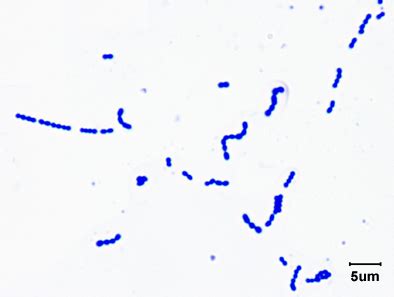 File:Gram stain of Streptococcus pyogenes.jpg - Wikimedia Commons