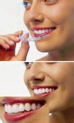 Ortodoncia Sin Brakets T Cnica Clear Aligner Odontolog A Online