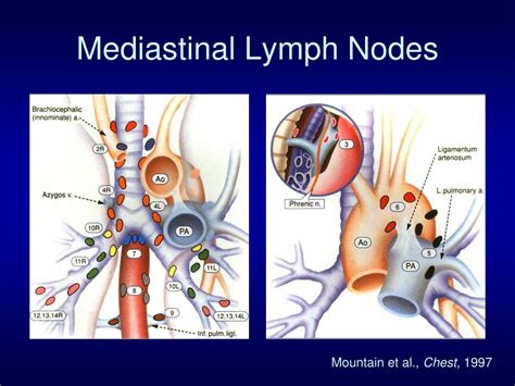 Ppt Mediastinal Staging For Lung Cancer Powerpoint Presentation Free