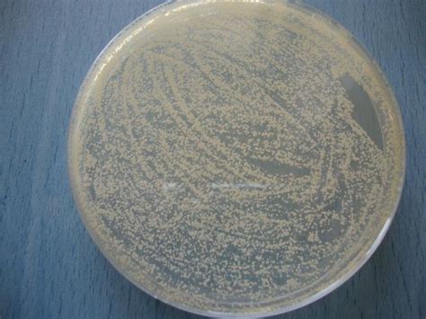 Candida Albicans On Sabouraud Agar Download Scientific Diagram