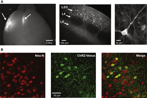 Layer Pyramidal Neurons Control The Gain Of Cortical Output Cell