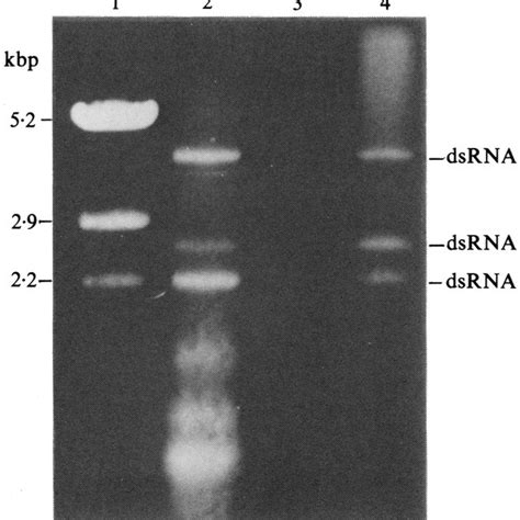 Identification of ssRNA and dsRNA species by native gel electrophoresis ...