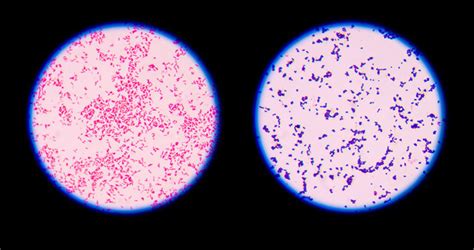 9 Gram Staining Best Practices – Microbiologics Blog