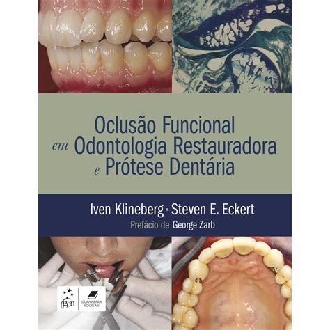 Livro Oclus O Funcional Em Odontologia Restauradora E Pr Tese