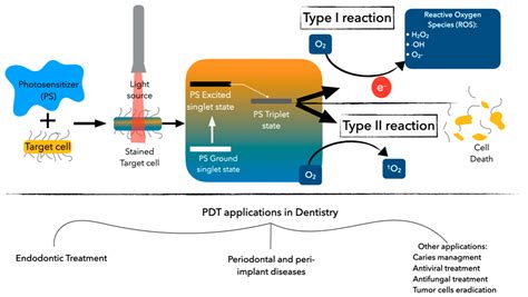 Antibiotics Free Full Text Photodynamic Therapy In Endodontics A Helpful Tool To Combat