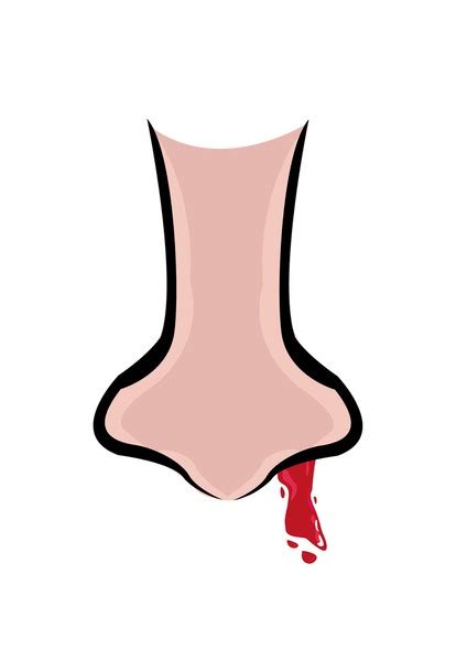 14 Bleeding Nose Diagram Royalty-Free Images, Stock Photos & Pictures ...