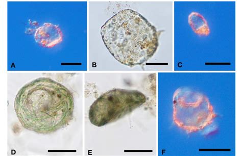 Photomicrographs of Amoebozoa (A-F). A, Centropyxis aerophila ...