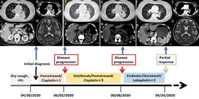 Frontiers Case Report Recombinant Human Endostatin Plus Chemotherapy