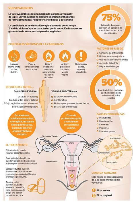 Candidiasis vaginal una enfermedad más frecuente de lo que pensamos