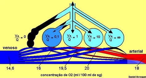 Fisioterapia em Terapia Intensiva Relações de ventilação perfusão