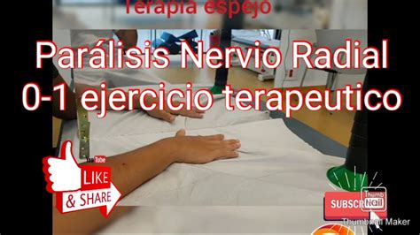 Parálisis nervio radial 0 1 ejercicios YouTube