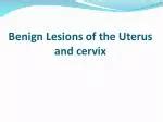 PPT BENIGN DISEASES OF THE UTERUS AND CERVIX PowerPoint Presentation