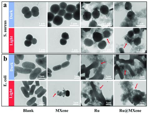 tem images  bacterial structure  morphology    aureus