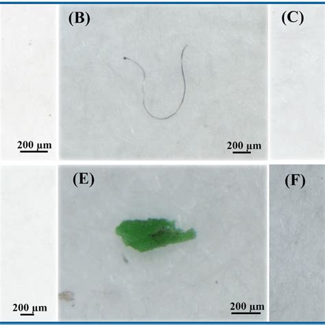 Abundance And Polymer Type Of Microplastics In The Atmosphere In Each