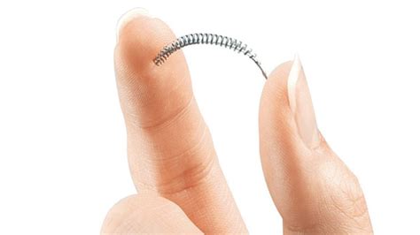 Essure birth control implant tied to greater need for 2nd surgical fix ...