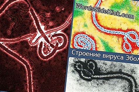Меланом: Симптоми, Лечение И Профилактика - 2024 | Здраве