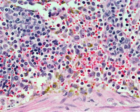 File Spleen Histology 07  Embryology